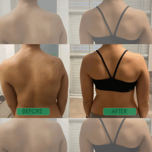 Corecare Posture Corrector (Official Retailer) 2025
